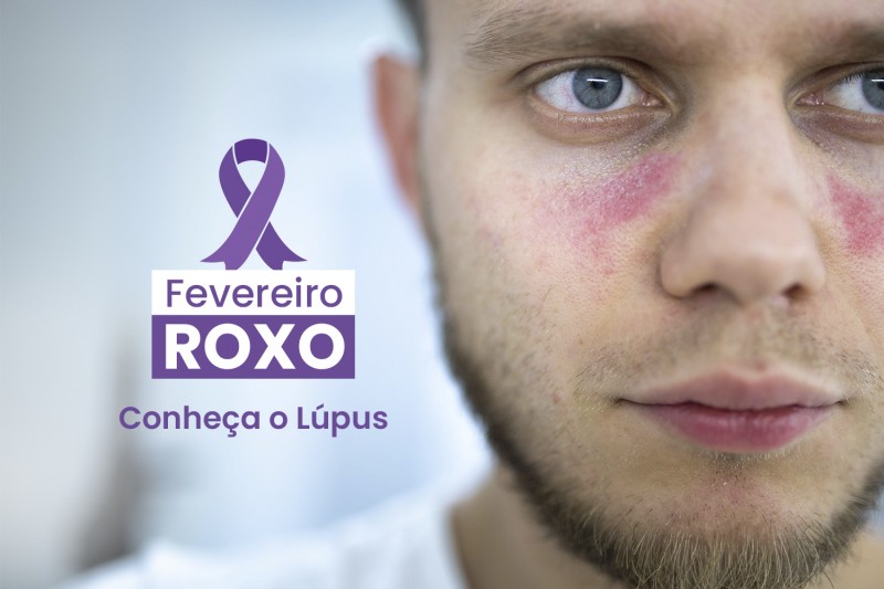 Foto de um homem branco do lado direito. Ele tem os olhos azuis. Do lado esquerdo temos um laço roxo e escrito Fevereiro Roxo. Conheça a Lúpus. 